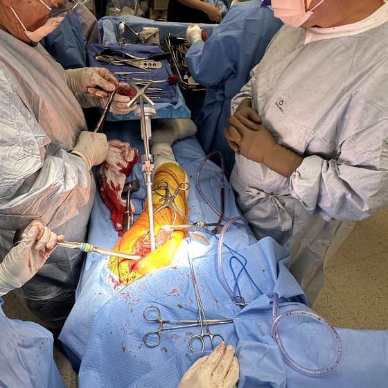 Caso real de artroplastia de cadera 12